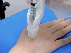 -杭州米兰柏羽医疗美容医院