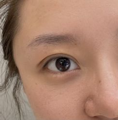 体验后-华臣医疗美容