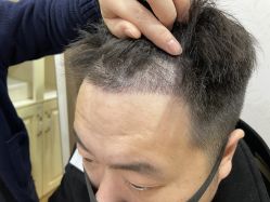 -熙朵美学植发·连锁品牌