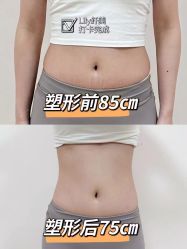 -Lily纤美·科技减脂中心