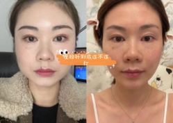 -东剑医学美容·注射美学中心