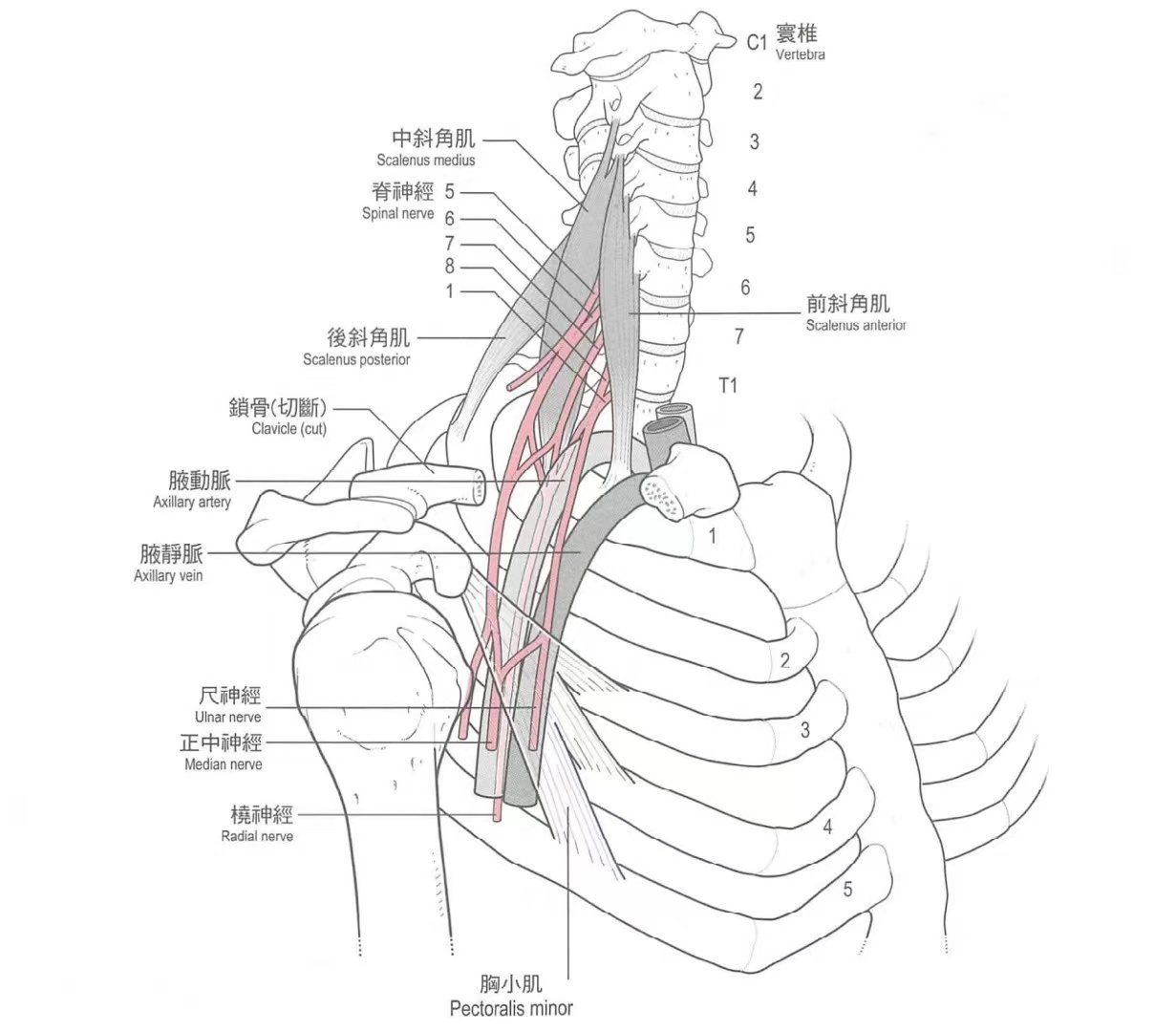 胸廓出口综合症