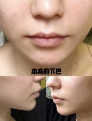 体验前-西安壹加壹医疗美容·西北抗衰旗舰店