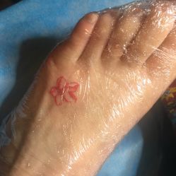 点击看大图 -新肤洗纹身