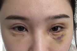 -成都艾特他整形外科医院