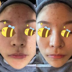 -苗方清颜痘肌研究所