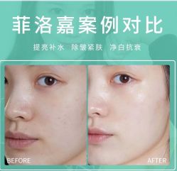 -E.beauty驻颜·痘敏肌调理中心