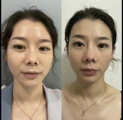 -素美医疗美容·西南眼鼻整形·修复基地