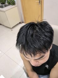 点击看大图 -大麦微针植发丨全国连锁