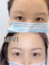 -MIVI半永久纹眉纹绣