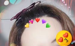 -大麦微针植发全国连锁