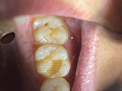 -同步齿科·数字化正畸种植口腔中心(前山店)
