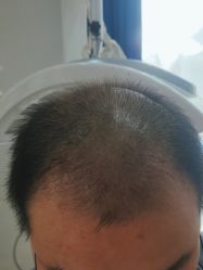 -雍禾植发全国连锁