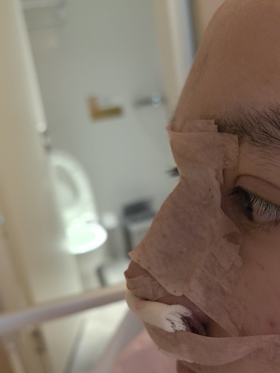 整容手术真实体验分享