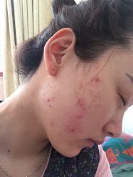 -皇族养心堂·净痘·修敏·御颜
