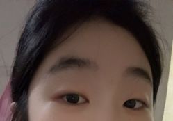 体验前-苏州维多利亚美容医院