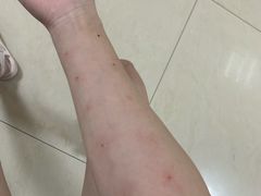 -重庆医科大学附属第一医院(本部)