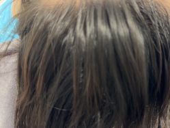 -熙朵美学植发·连锁品牌