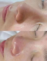 -痘庄科学祛痘国际连锁