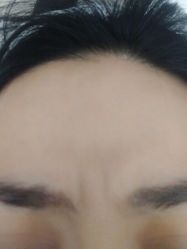 体验前-北京楚诺医疗美容