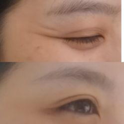 体验前-杭州医巢医疗美容