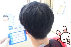 -大麦微针植发丨全国连锁