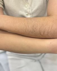 -薇兰专业脱毛连锁机构