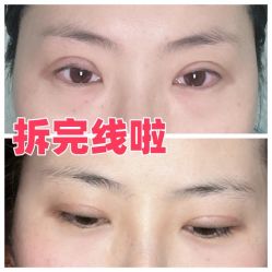 -素美医疗美容·西南眼鼻整形·修复基地