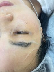 -长沙雅美医疗美容医院