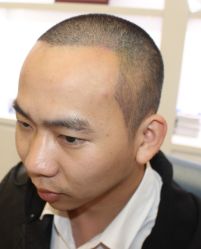 -大麦微针植发全国连锁