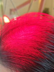 -碧莲盛·不剃发植发