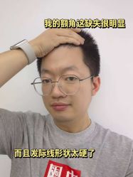 -雍禾植发全国连锁