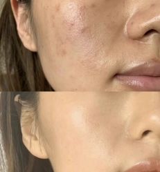 -SKIN79皮肤管理中心
