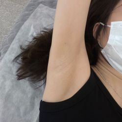 -MUSES专业脱毛比基尼サロン日式连锁