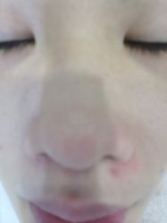 -痘院长·祛痘·皮肤管理