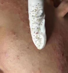 -荟草堂专业祛痘修护中心