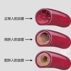 点击看大图 -香薇妮丝女子减肥院
