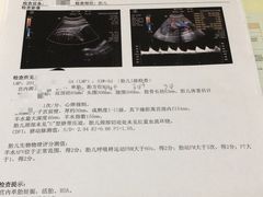 -伊丽莎白妇科医院·早孕检查