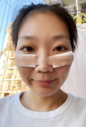 体验后-深圳美莱医疗美容医院