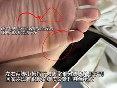 -郑远元专业修脚房(国顺东路店)