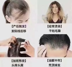 -诗碧曼·头疗养发馆