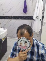 -唐风采假发补发定制