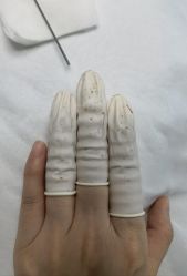 体验后-宜肤清颜专业祛痘问题肌修护