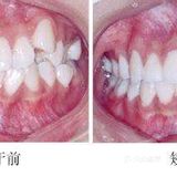 什么是口腔正畸？