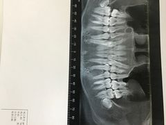 -上海市杨浦区牙病防治所