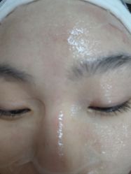 体验后-深圳广和门诊部·整形医疗美容