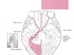 -多特儿童专注力·感统训练·注意力提升培训(锦峰训练中心)