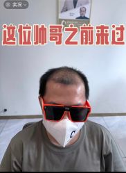 -唐风采假发补发定制