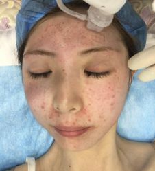 体验后-和颜一美轻医美连锁