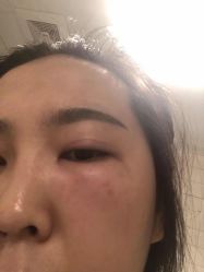-新美荟医美·专注面部美学抗衰